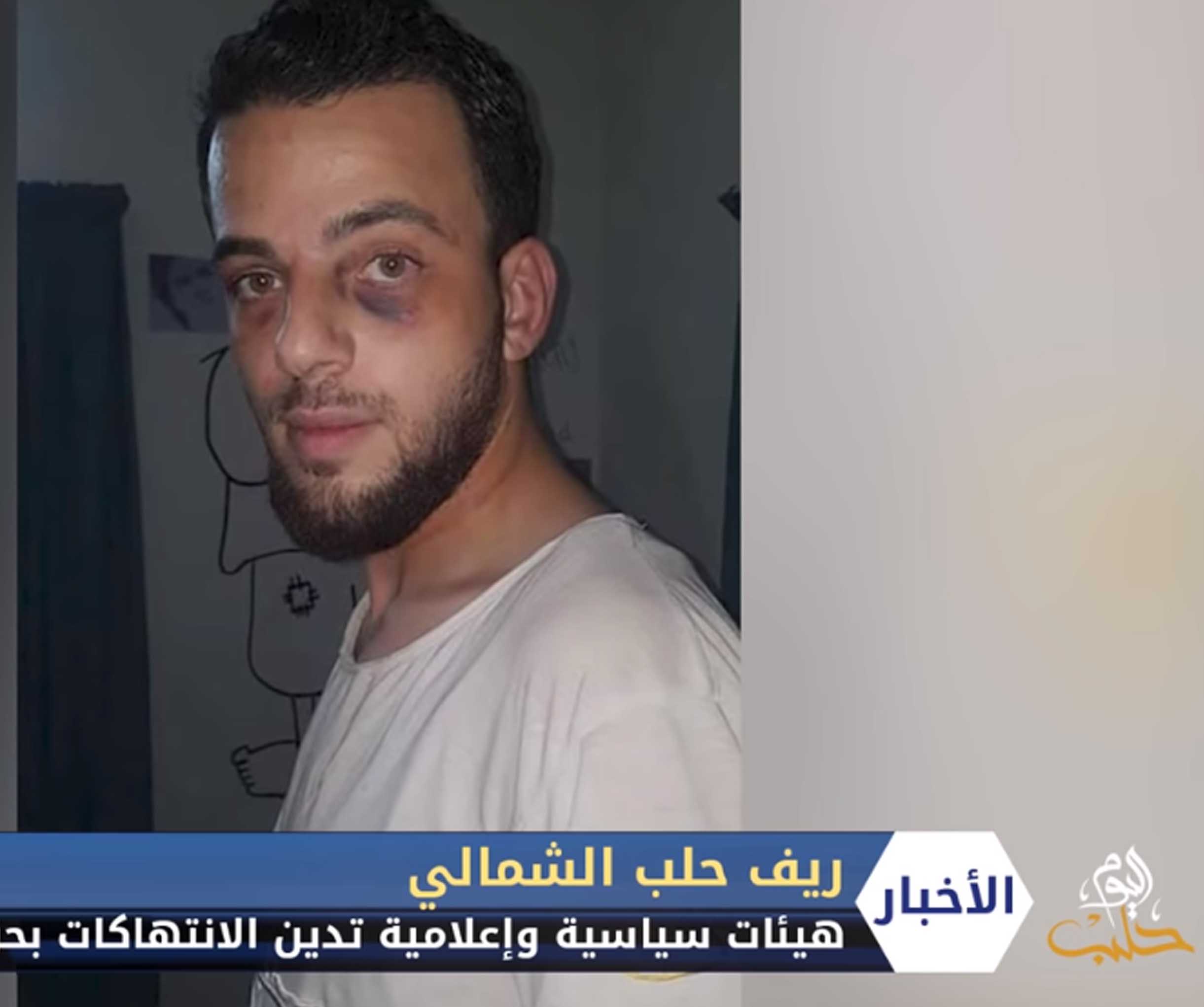 إدانات لاعتقال وتعذيب الإعلامي بلال سريول من قبل مجموعة تابعة لفرقة السلطان مراد بعفرين