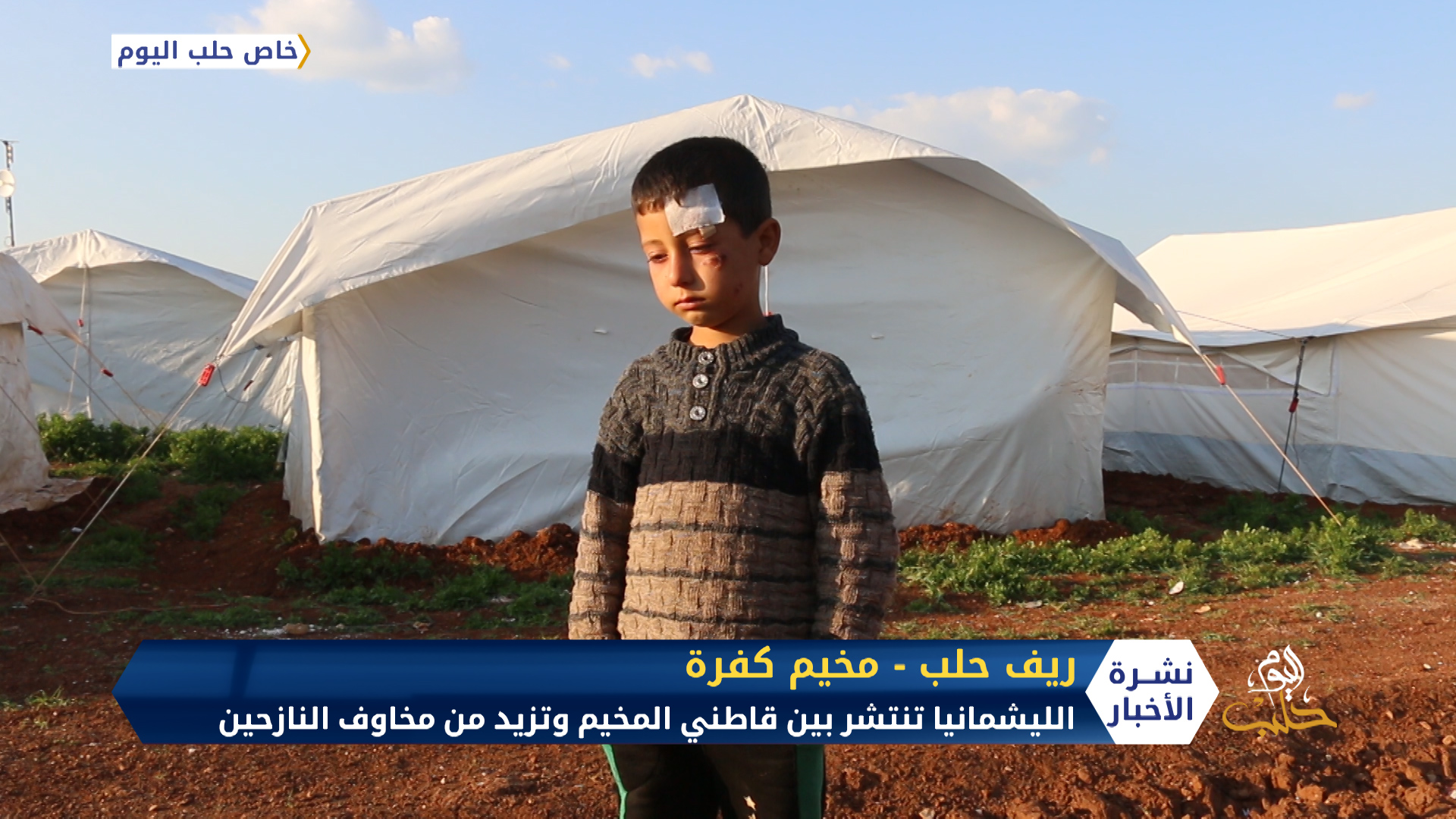 الليشمانيا تنتشر في مخيم كفرة شمال حلب وتزيد من مخاوف النازحين