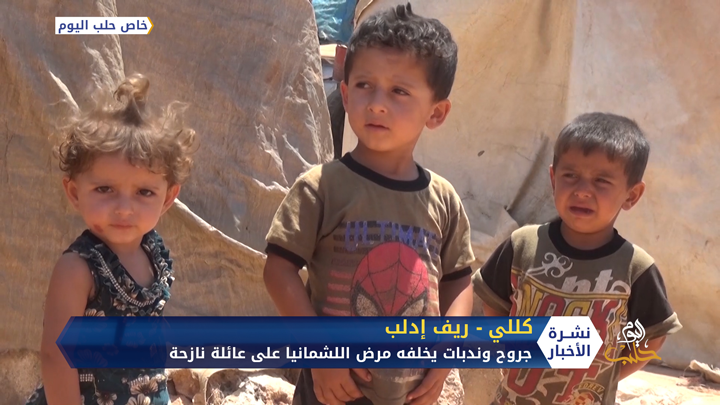 اللشمانيا في مخيمات النازحين.. انتشار كبير في ظل غياب الحلول