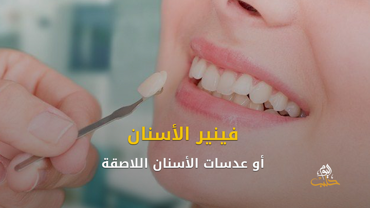 شببلك 92- ابتسامة هوليود وكيفية الحصول عليها