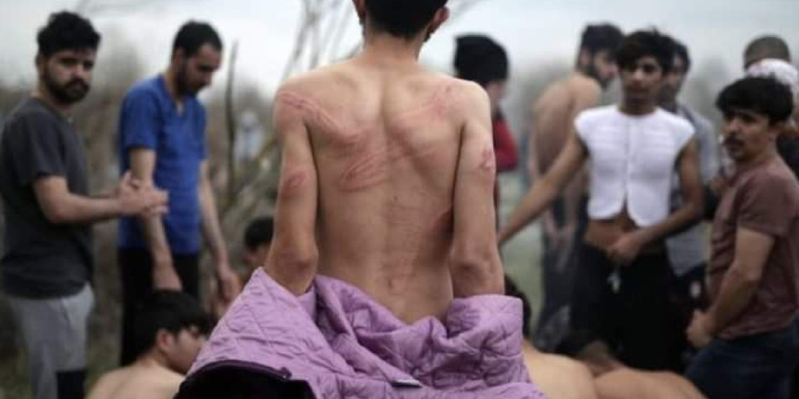 يتعرض غالبية المهاجرين في جنوب شرقي أوروبا للتعذيب خلال عمليات الصد