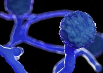 تسجيل حالة وفاة بالفطر الأسود في حمص