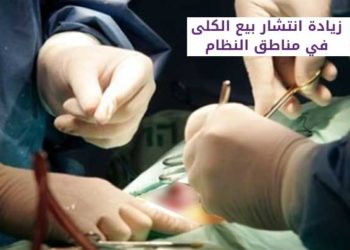 طبيب يؤكد زيادة انتشار بيع الكلى في مناطق النظام