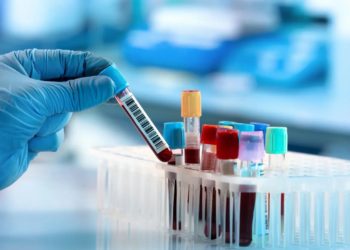 ارتفاع عشوائي لأجور التحاليل الطبية في مناطق النظام.. ومسؤول حكومي يبرر