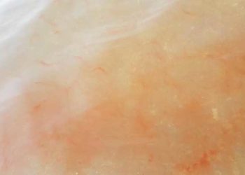 ظاهرة غريبة تحدث في بحيرة “طبرية” في الجولان السوري