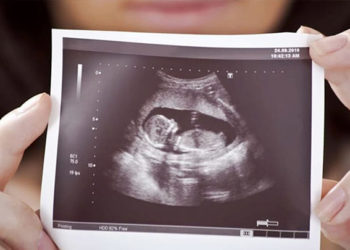 المتخصص بالجراحة النسائية في جامعة دمشق الدكتور "هيثم عباسي": كانت ترد 10 استفسارات بالشهر قبل 10 سنوات فحالياً قد تصل 100 حالة شهرياً ما يعني أن النسبة تضاعفت بمقدار 1000%