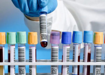 التحاليل الطبية دمشق ارتفاع الأسعار