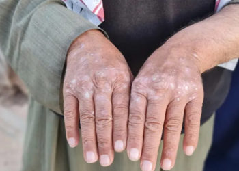 الفطريات الجلدية