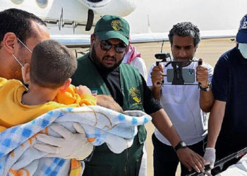 التوأم السيامي