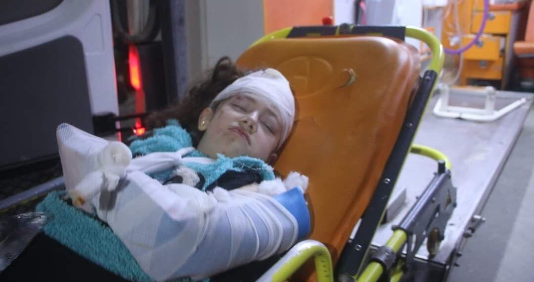 طفلة مصابة بقصف صاروخي على ريف إدلب