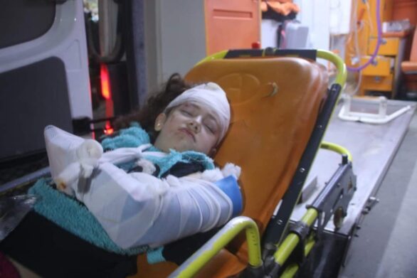 طفلة مصابة بقصف صاروخي على ريف إدلب