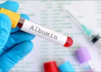 صورة تعبيرية الألبومين