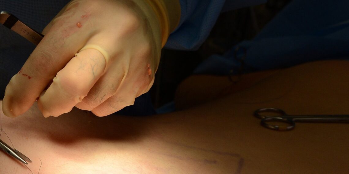 لبنانيون شارفوا على الموت بسبب عمليات تجميل “رخيصة” في دمشق