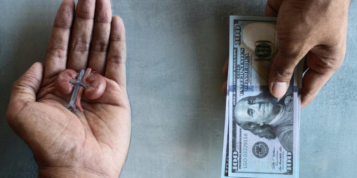 لاجئ فلسطيني سوري يعرض كليته للبيع في لبنان